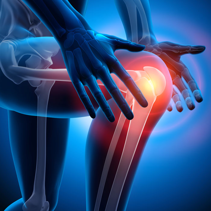 膝の痛みに対する多⾎⼩板⾎漿（PRP）治療
